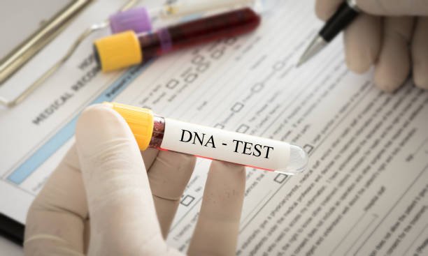 A DNA test | Source: Pexels